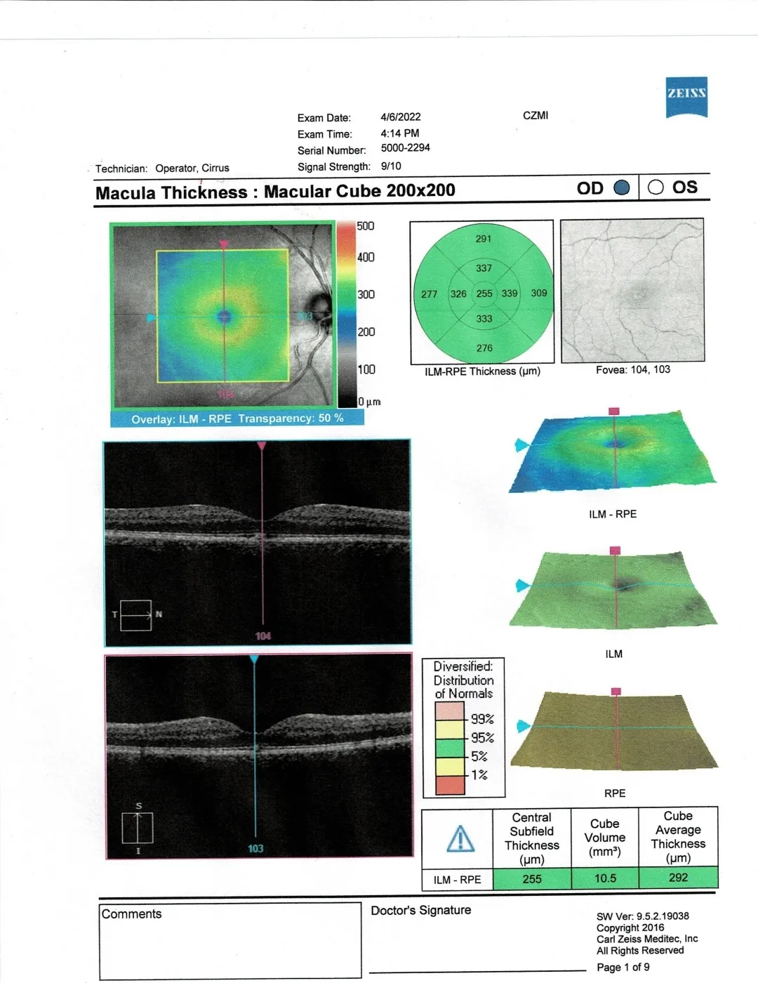 OCT macular thickness report, right eye (2022)
